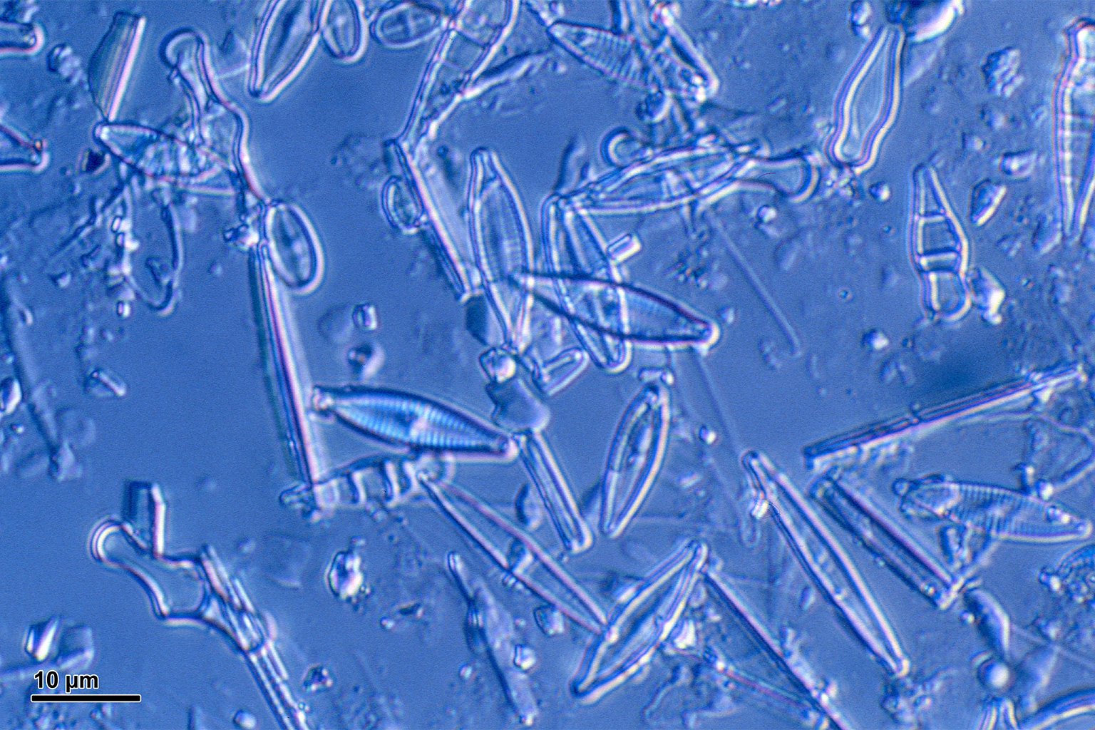 diatoms